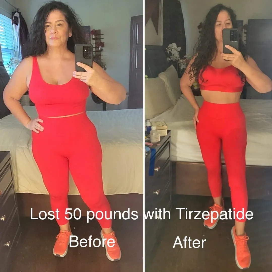 Patty before and after